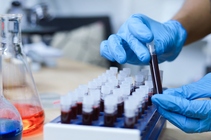 Photo shows a scientist holding a test tube with blood in a laboratory/Getty Images