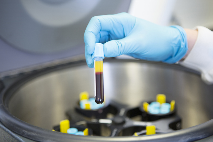 Photo shows the centrifugation of blood to produce platelet plasma/Getty Images