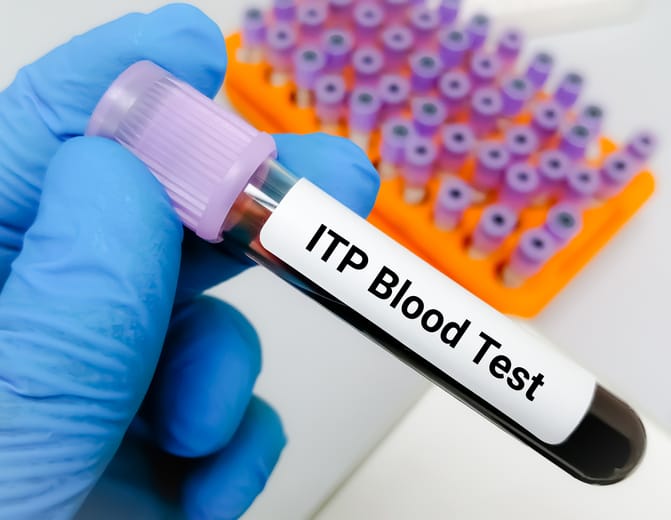 Photo shows an immune thrombocytopenic purpura (ITP) blood test/Getty Images