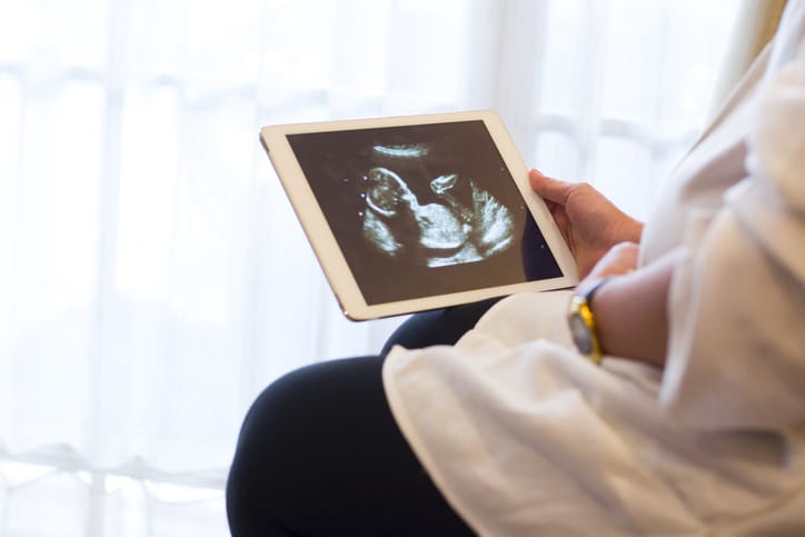 Photo shows a pregnant woman looking at an ultrasound image/Getty Images