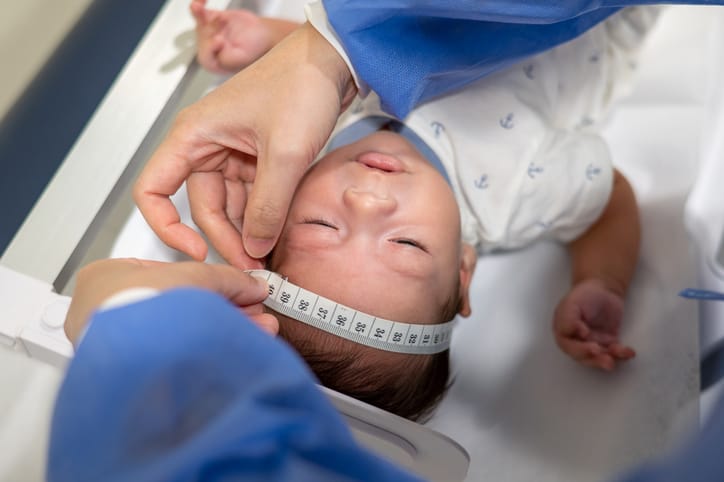A doctor measures a newborn baby's head/Getty Images