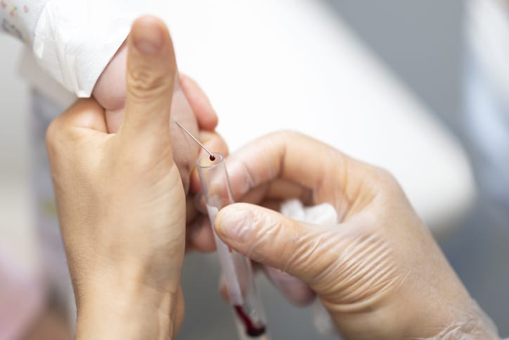 The photo shows blood being drawn from a baby's hand/Getty Images
