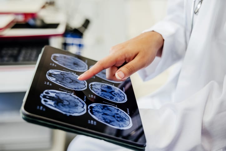 Photo shows a close-up view of a doctor's hand pointing at brain scan images displayed on a digital tablet/Getty Images