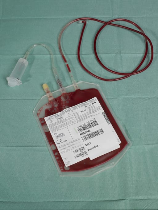 Photo shows umbilical cord blood for stem cell harvesting in a bag/Getty Images