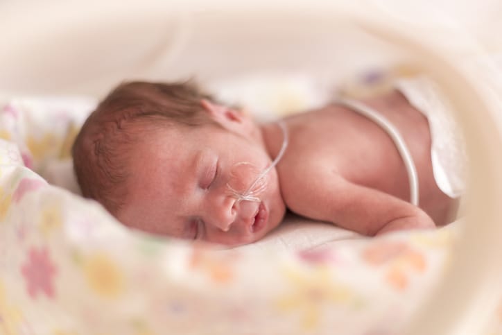Photo shows a premature newborn baby in the hospital incubator after c-section at 33 weeks/Getty Images