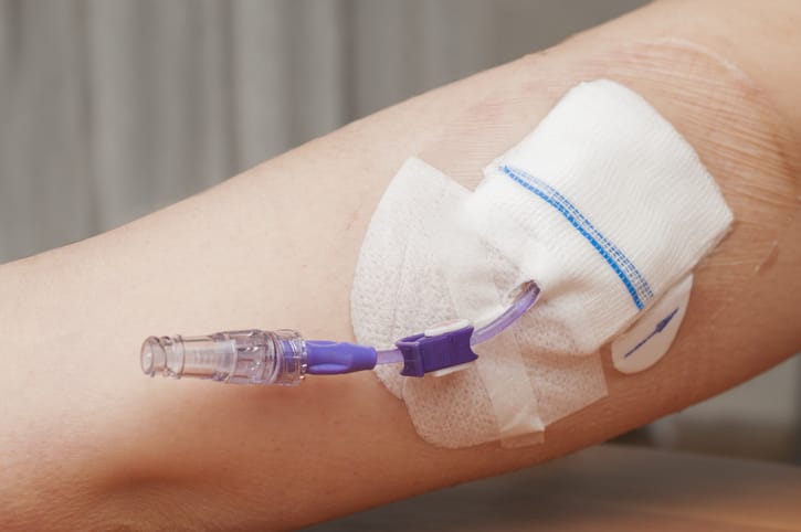 Photo shows a PICC (Peripherally Inserted Central Catheter) in the arm of a young woman/Getty Images
