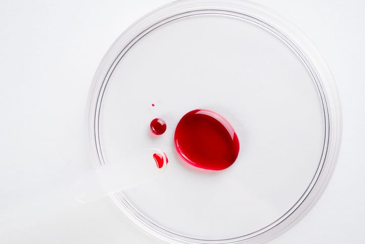 Photo shows a drop of blood In a glass petri dish/Getty Images
