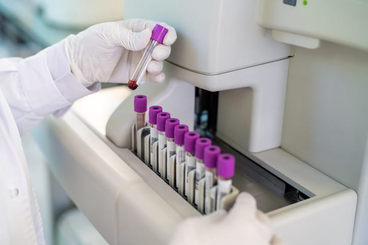 Photo shows a doctor looking at blood samples in test tubes in a machine/Getty Images
