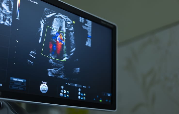 Photo shows an ultrasound sonogram of a fetus at 22 weeks old/Getty Images