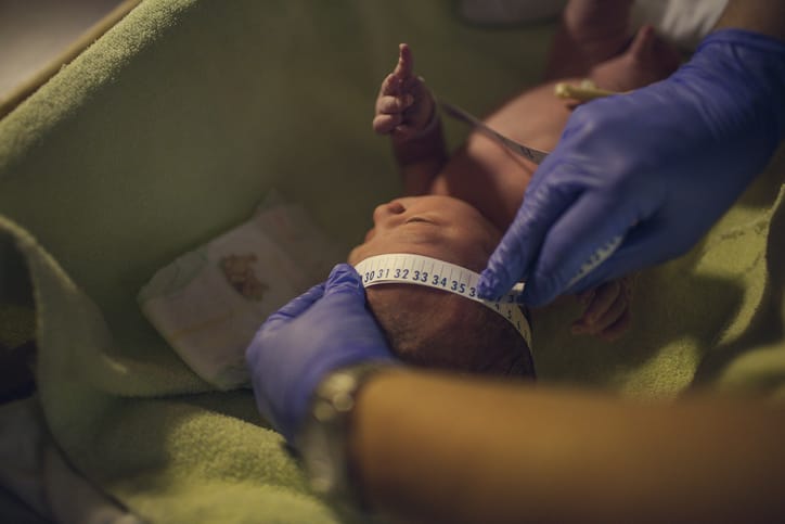 Photo shows a doctor measuring a newborn baby's head/Getty Images