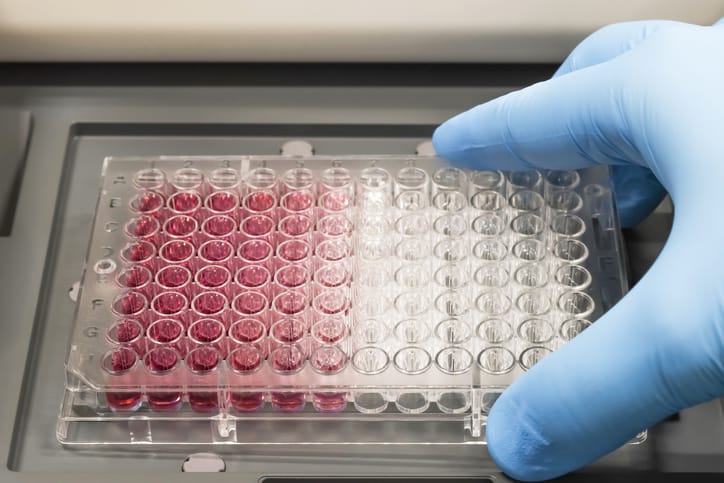 Photo shows a multiwell plate for ELISA and immunological tests in a research laboratory/Getty Images/TopMicrobialStock