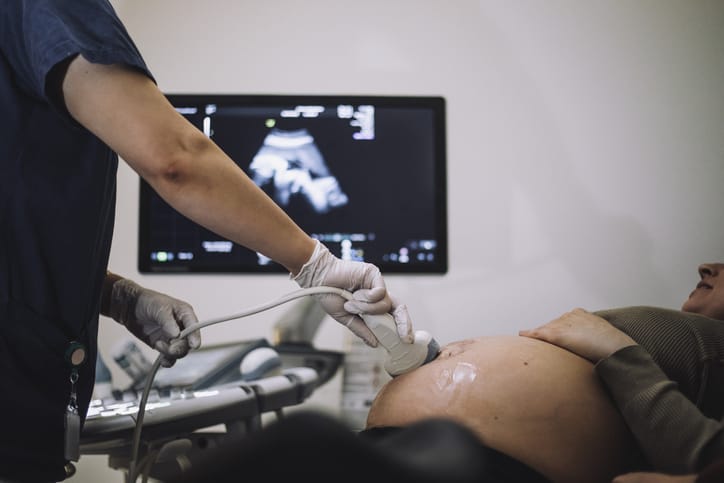 Photo shows a gynecologist performing an ultrasound on a pregnant woman/Getty Images/Maskot