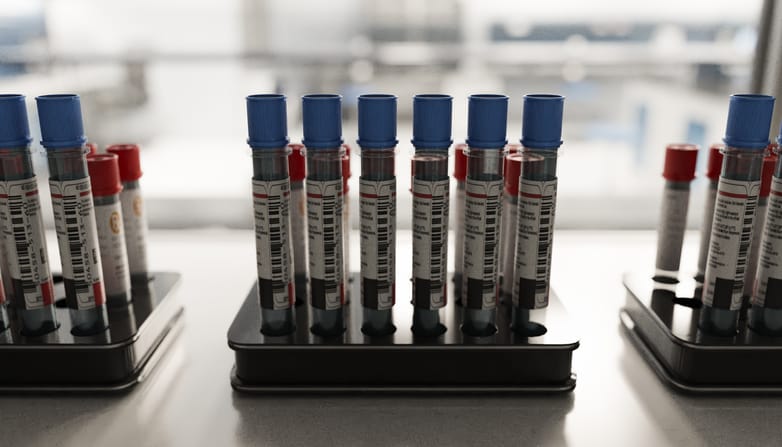 Photo shows blood-filled test tubes lined up for laboratory analysis/Getty Images/ aire images