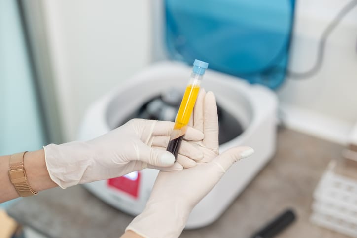 Photo shows a close up shot of a doctor's hands with surgical gloves while preparing blood collection tubes (Getty Images/Jecapix)